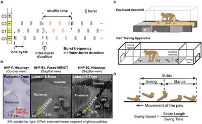 Effect of subthalamic coordinated reset deep brain stimulation on Parkinsonian gait